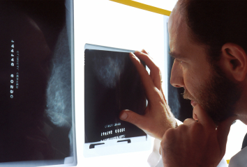 3 стадия рака молочной железы: лечение и симптомы, прогноз при 3 степени рака молочной железы